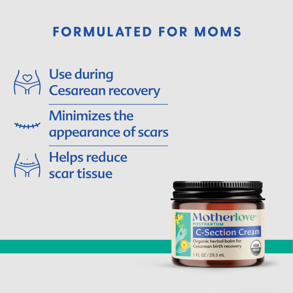 C-SECTION CREAM 1 OZ MOTHERLOVE